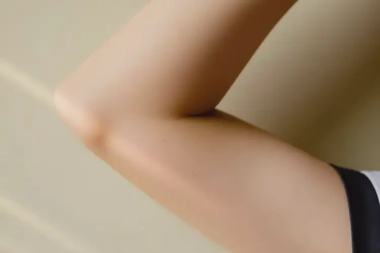 中學生手臂上出濕疹可不可以徹底自愈(圖4)