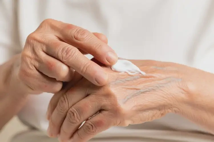 高龄老人四肢容易起湿疹不管它会自己痊愈吗(图4)