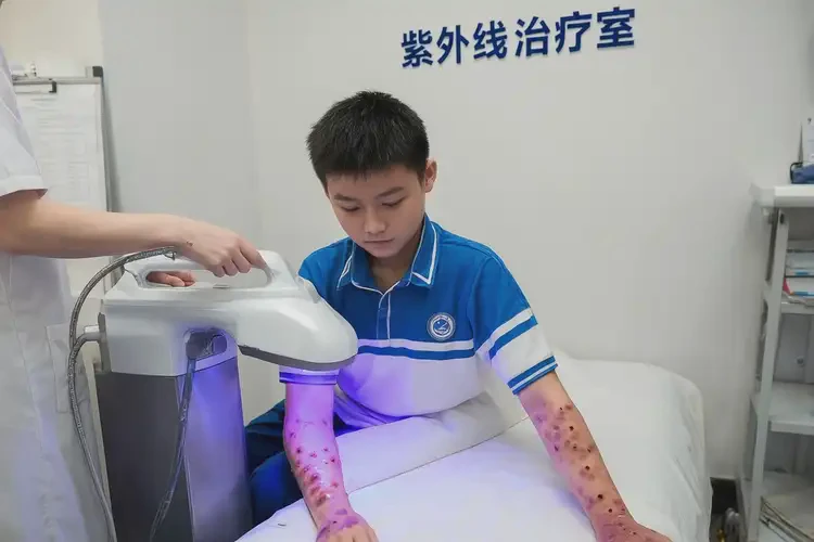 中學(xué)生四肢有濕疹能夠徹底治愈嗎(圖2)