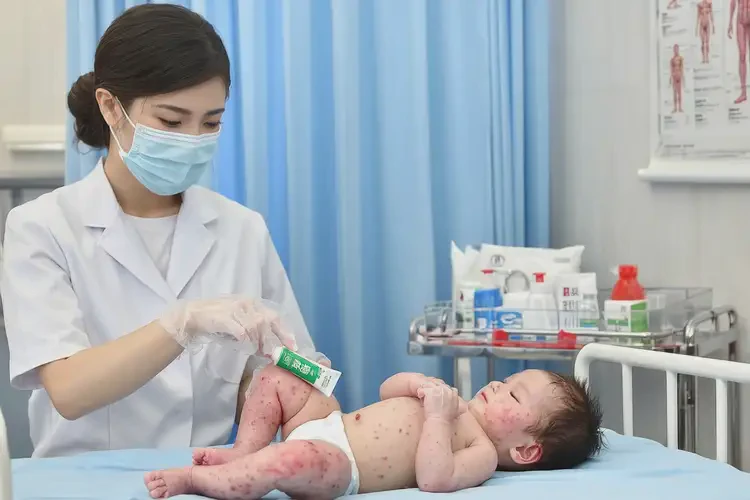 婴幼儿大腿上起湿疹可以彻底自愈吗(图3)