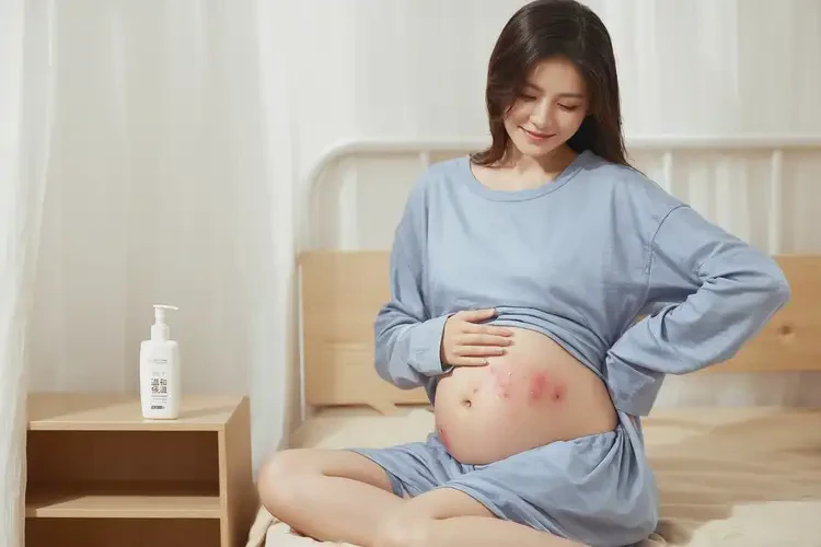 哺乳期妈妈肚子容易长湿疹不管它会自己好吗(图3)