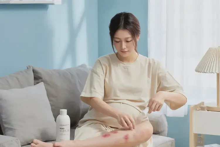 孕婦小腿上出現(xiàn)濕疹能夠徹底治愈嗎(圖3)
