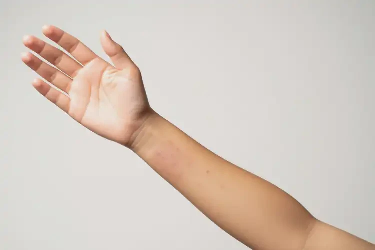 女性手臂上起濕疹不管它會(huì)自己自愈嗎(圖1)