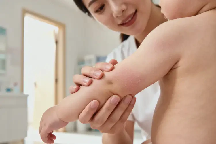嬰幼兒身上長(zhǎng)濕疹能夠徹底治愈嗎(圖1)