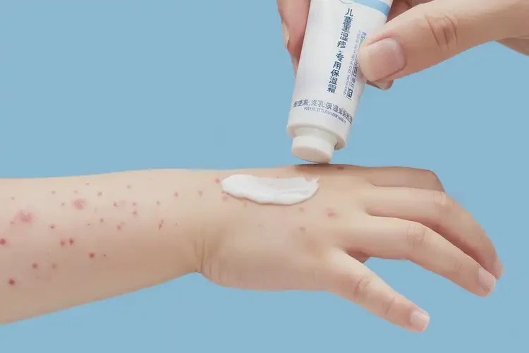 小兒手上經常長濕疹能靠自己自愈嗎(圖2)