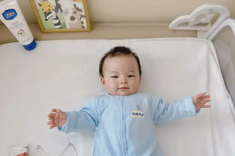 嬰幼兒全身經(jīng)常起濕疹可以徹底自愈嗎(圖1)