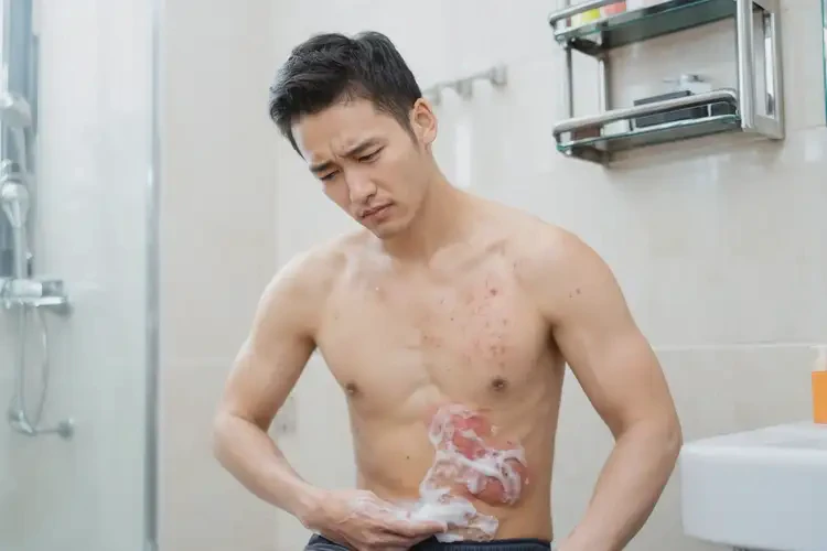 男生肚子上偶爾長濕疹能徹底自愈嗎(圖2)