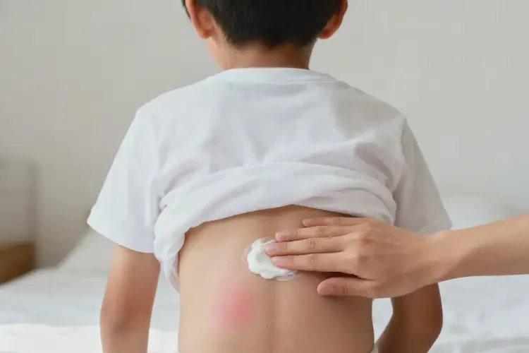 小學(xué)生肚子偶爾起濕疹能夠徹底治愈嗎(圖3)