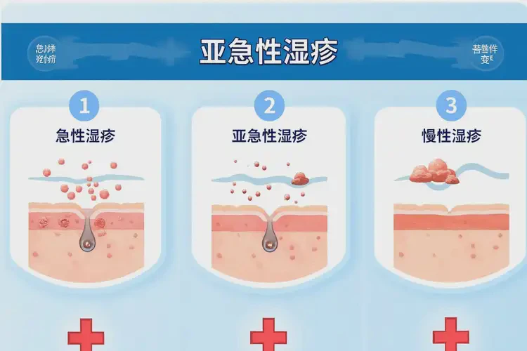 男性面部經(jīng)常起濕疹可不可以徹底自愈(圖3)