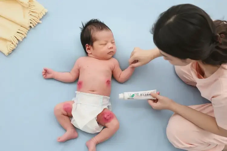 新生兒大腿上容易起濕疹可以徹底自愈嗎(圖3)