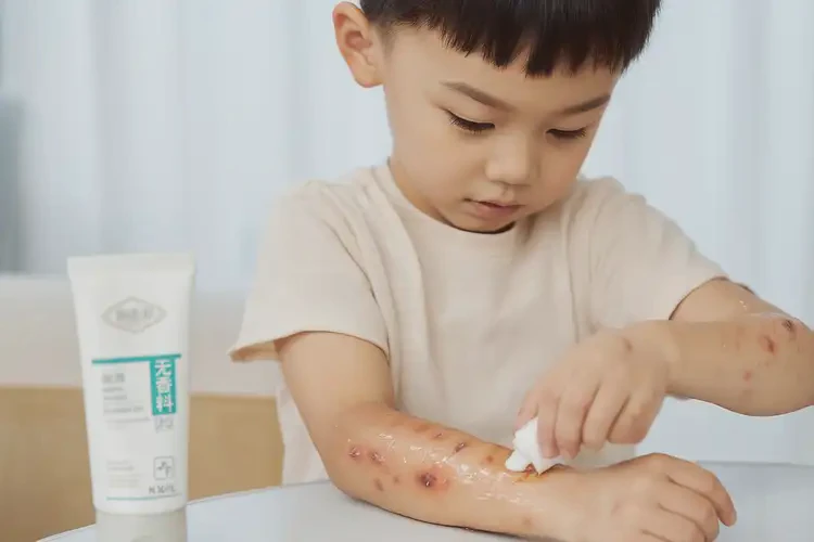 小學生手臂上出現(xiàn)濕疹可不可以徹底自愈(圖3)