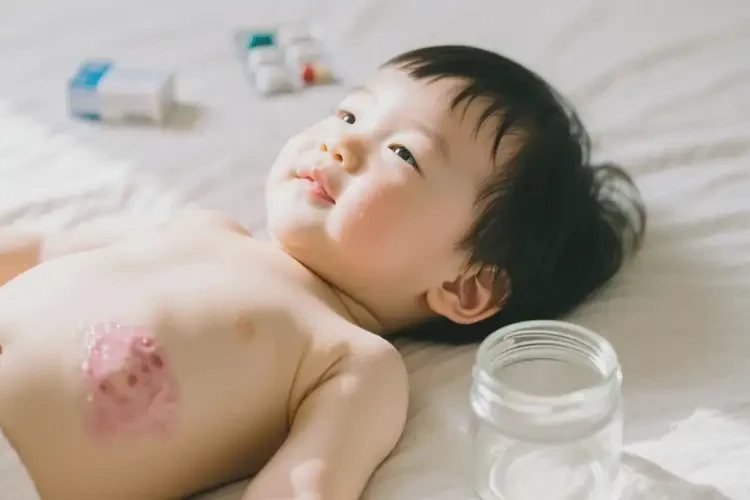 幼兒肚子上偶爾長濕疹可不可以徹底自愈(圖1)