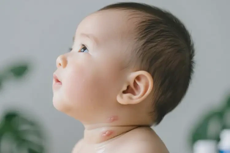 孩子脖子偶爾長濕疹不管它會自己自愈嗎(圖2)