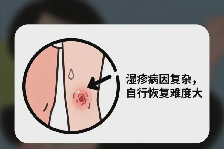 女人大腿起濕疹不管它會(huì)自己好嗎(圖1)