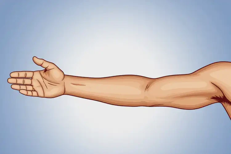 男生手臂容易長濕疹不管它會自己痊愈嗎(圖4)