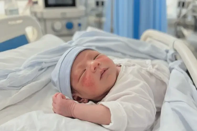 新生兒臉上有濕疹能靠自己自愈嗎(圖3)