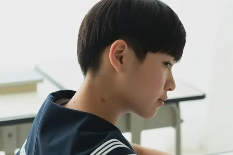 中學(xué)生脖子有濕疹能靠自己自愈嗎(圖4)