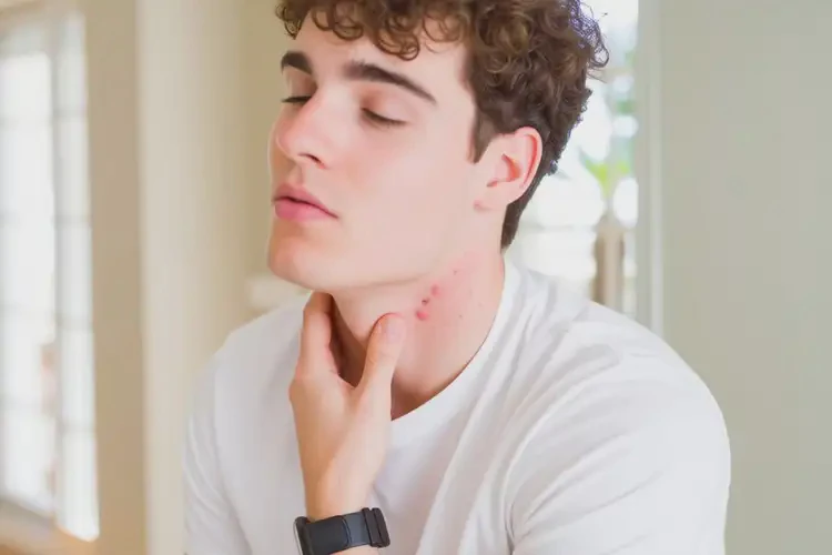 大學(xué)生脖子上容易起濕疹不管它會自己痊愈嗎(圖4)