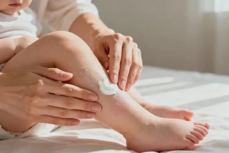 嬰兒小腿上容易起濕疹能夠徹底治愈嗎(圖1)