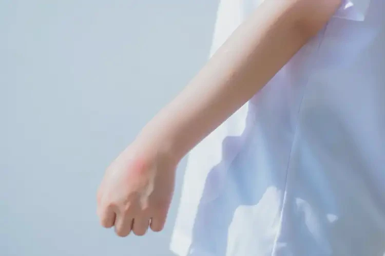 中學生手臂上出濕疹可不可以徹底自愈(圖1)