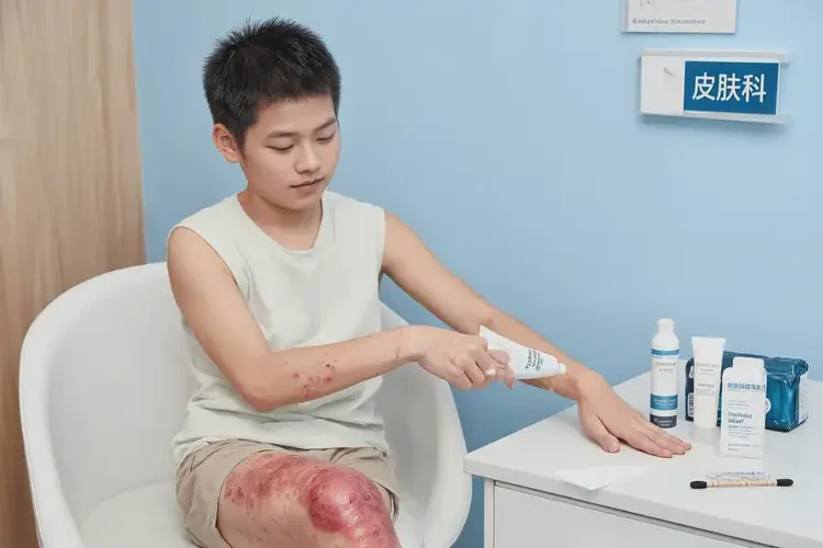 青少年大腿上容易起濕疹能靠自己自愈嗎(圖3)