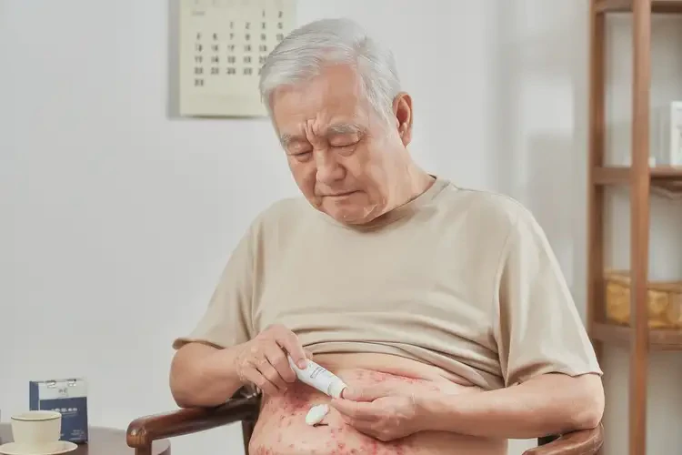 老年人肚子長(zhǎng)濕疹能靠自己自愈嗎(圖2)