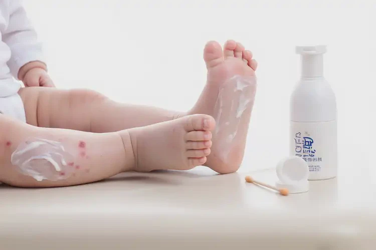 幼兒腳上經(jīng)常起濕疹可不可以徹底自愈(圖3)