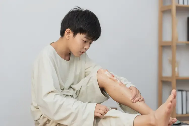 中學(xué)生大腿上有濕疹不管它會自己痊愈嗎(圖1)