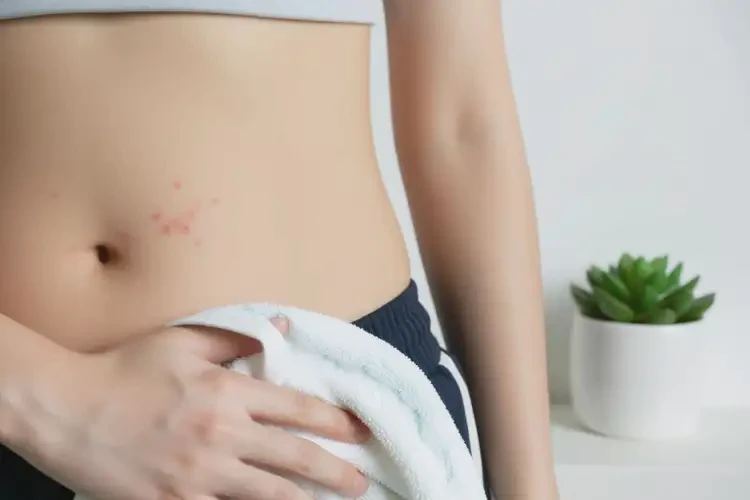 大學(xué)生肚子偶爾長濕疹能夠徹底治愈嗎(圖3)