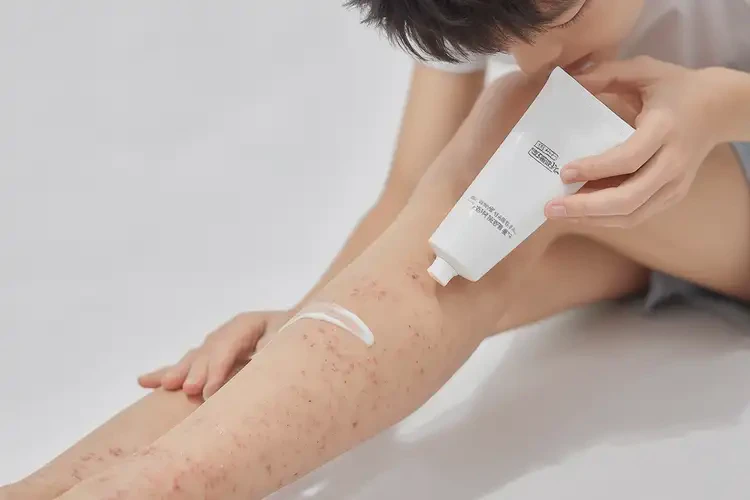 青少年小腿上偶爾起濕疹不管它會自己自愈嗎(圖3)