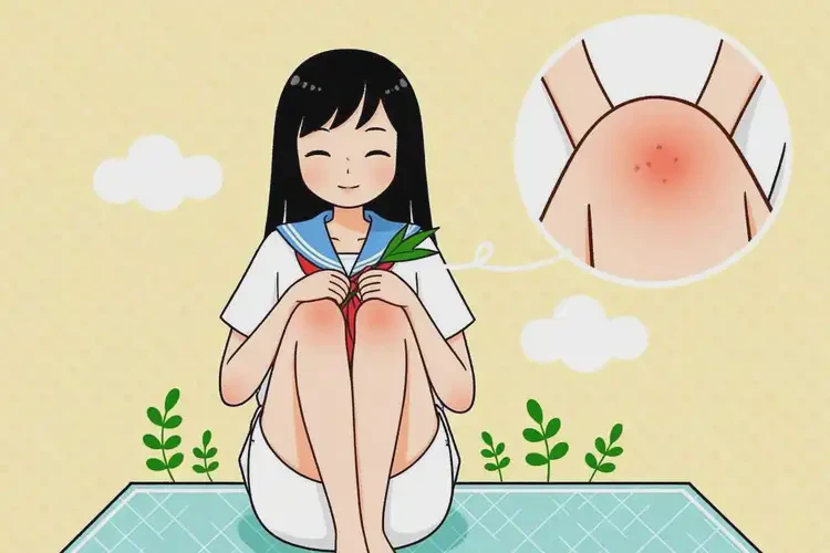 中學(xué)生大腿容易長濕疹能夠徹底治愈嗎(圖4)