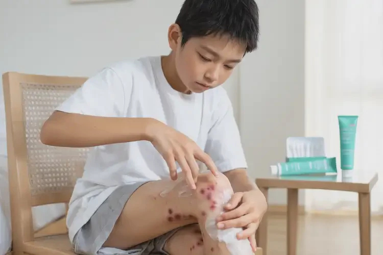 青少年小腿容易長濕疹不管它會自己痊愈嗎(圖2)