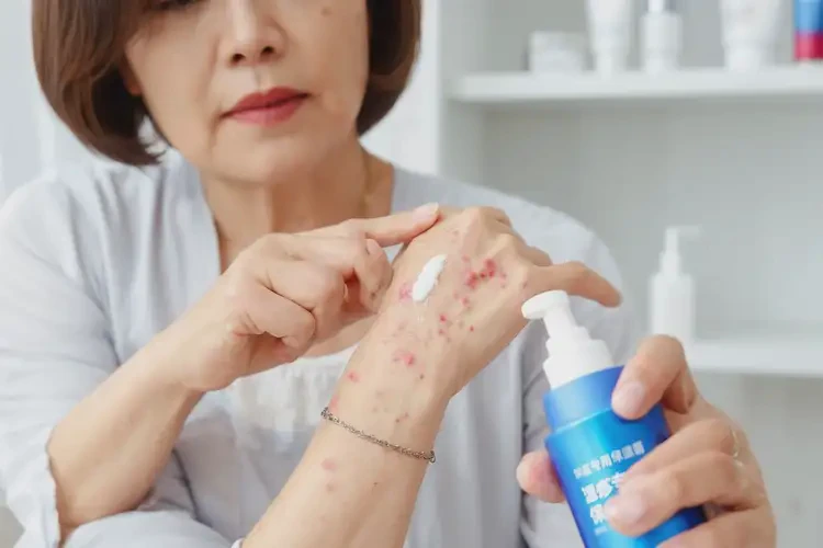女人手上出濕疹不管它會(huì)自己自愈嗎(圖3)