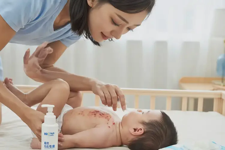 寶寶脖子上長濕疹可以徹底自愈嗎(圖3)