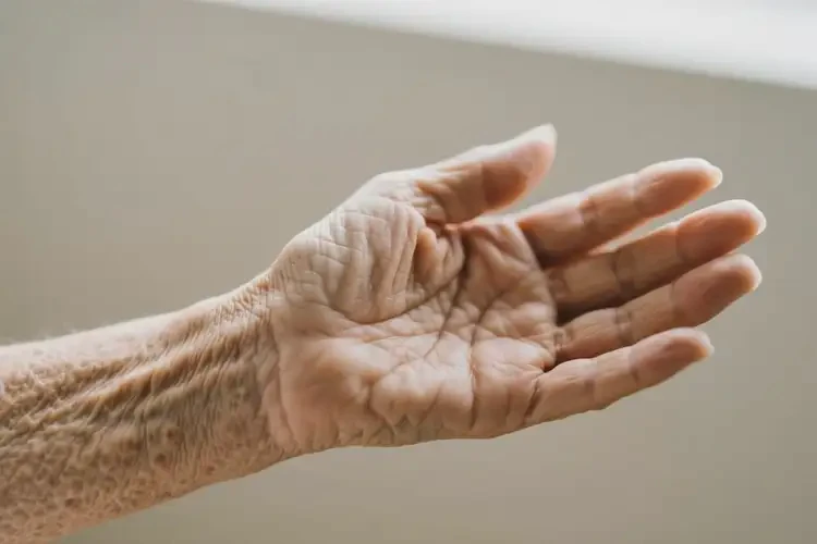 老人手臂偶爾起濕疹不管它會(huì)自己自愈嗎(圖1)