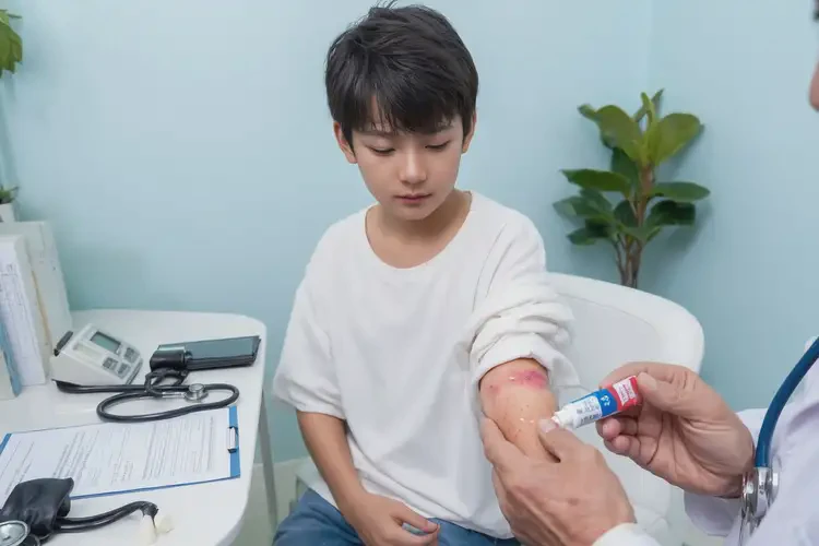 青少年屁股上起濕疹能徹底自愈嗎(圖2)