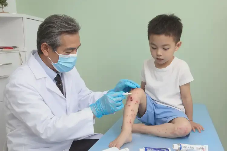 小孩小腿上出濕疹不管它會(huì)自己自愈嗎(圖3)