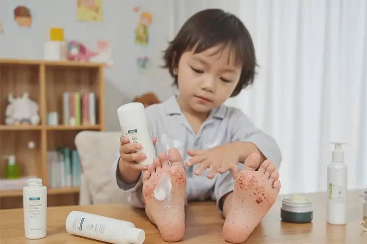 少兒腳上經(jīng)常長濕疹可以徹底自愈嗎(圖3)