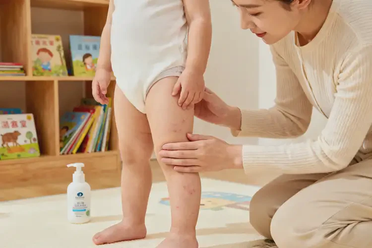 宝宝大腿上经常长湿疹可以彻底自愈吗(图1)