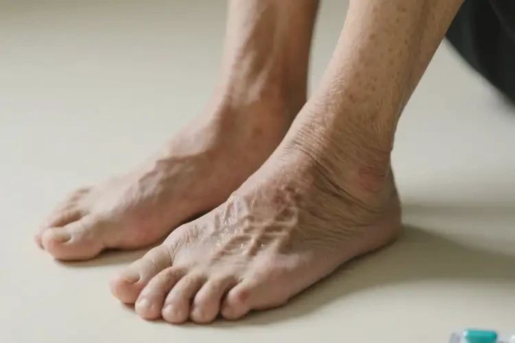 老年人腳上長濕疹不管它會自己好嗎(圖4)