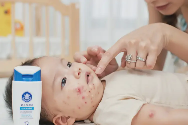 小孩脖子長(zhǎng)濕疹可不可以徹底自愈(圖4)