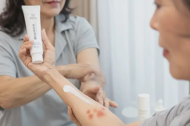 女性全身有濕疹能靠自己自愈嗎(圖3)