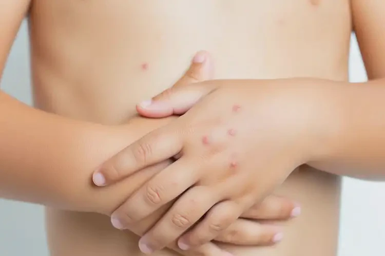 孩子手臂上經(jīng)常長(zhǎng)濕疹不管它會(huì)自己自愈嗎(圖4)