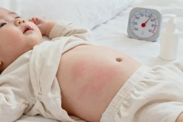 嬰兒肚子長(zhǎng)濕疹可不可以徹底自愈(圖2)