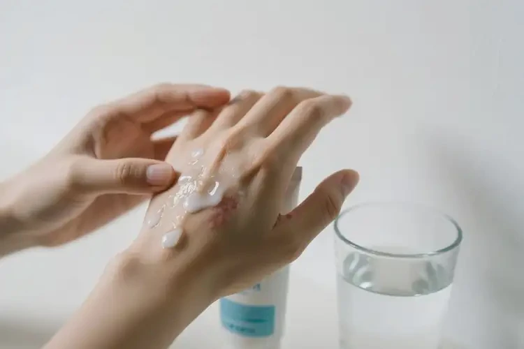 大學(xué)生手上出濕疹能徹底自愈嗎(圖1)