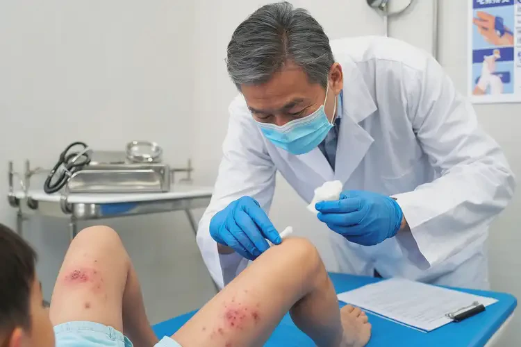 兒童大腿經(jīng)常起濕疹不管它會(huì)自己自愈嗎(圖3)