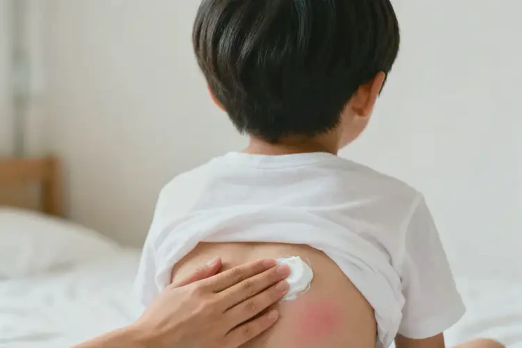 小學(xué)生肚子偶爾起濕疹能夠徹底治愈嗎(圖2)