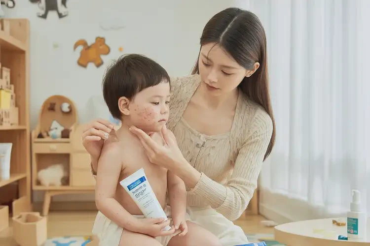 小孩臉上出濕疹可以徹底自愈嗎(圖3)