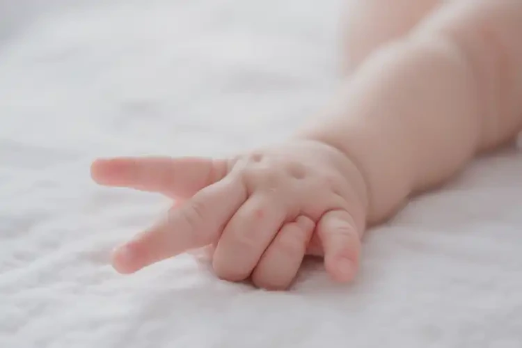 寶寶手上起濕疹不管它會(huì)自己自愈嗎(圖2)