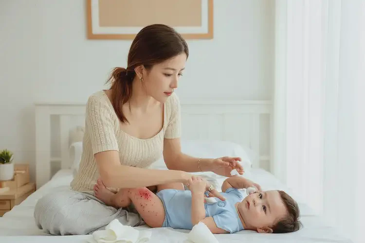 寶寶小腿有濕疹不管它會自己好嗎(圖3)